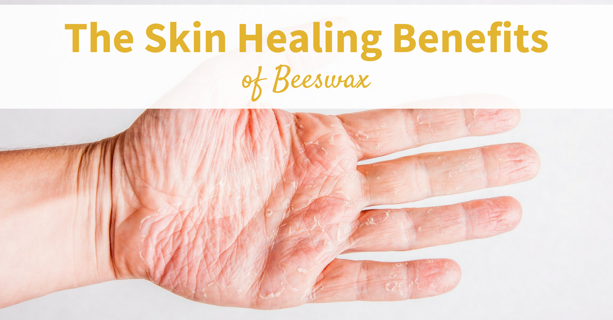 Health and Beauty Benefits of Beeswax  Beeswax, Hair growth foods, Beeswax  recipes